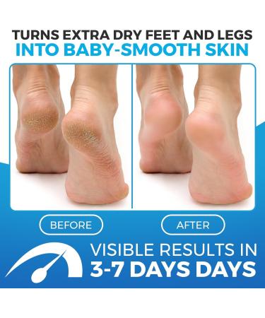 Imperial Feet Foot Balm Green 150 ML - Cream for Dry Skin & Feet, Anti-Fungal with Aloe Vera - Hydrating Formula for Dry Skin Relief - Pack of 1 - Buy Online on GoSupps.com