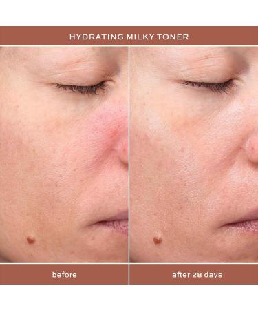 ITK Hydrating Milky Face Toner | Tone & Prep Skin with Hyaluronic Acid & Squalane | Reduce Redness & Hydrate | 5 fl. oz - Shop Internationally - Buy Online on GoSupps.com