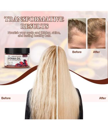 100% Natural Raw Batana Oil for Hair Growth Organic Batana Oil from Honduras Natural Pure Batana Oil for Men and Women Oil Control Moisturizing Reduce Split Ends - Buy Online on GoSupps.com
