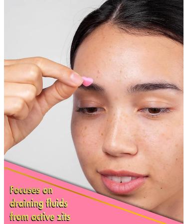 Truly Beauty Heart Your Imperfections Acne Patches - 36 Hydrocolloid Pimple Patches for Face - Cute Heart Shapes, Zit & Blemish Treatment - Buy Online on GoSupps.com
