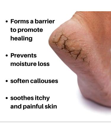Nordic Care Foot Care Cream 6oz - 10% Urea for Dry Skin & Cracked Heels Treatment - Buy Online on GoSupps.com