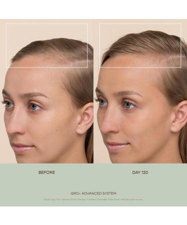 VEGAMOUR GRO+ Advanced Balancing Shampoo - Exfoliating & Cleansing for Thinning Hair Color Safe Vegan & Cruelty-Free (8 Fl Oz - Buy Online on GoSupps.com