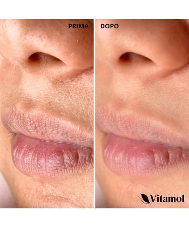 Vitamol Biosoft Sebum Regulating Cream against skin impurities acne pimples and blackheads - 40 ml - Buy Online on GoSupps.com