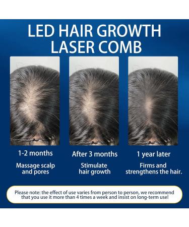 LED Hair Growth Laser Comb Red Light Therapy Hair Loss Treatment for Women Men - Hair Growth System for Thinning Hair - Buy Online on GoSupps.com