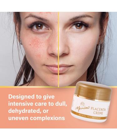 Placenta & Vitamin C B5 E & Propolis Refining Face Treatment by Merino - Buy Online on GoSupps.com