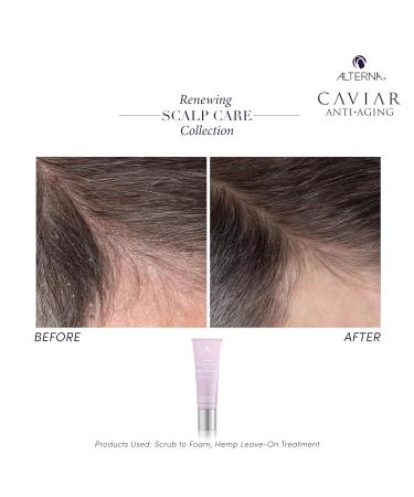 Alterna Renewing Scalp Care Treatment - Vegan Hemp Formula for Dry Scalp Lightweight & Fast Absorbing 74mL | International Shipping Available - Buy Online on GoSupps.com