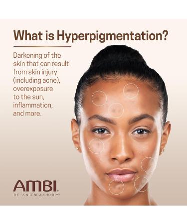 Ambi Even & Clear Fade Cream - Hyperpigmentation Treatment, Dark Spot Corrector with Niacinamide & Licorice Root Extract - 1 Fl Oz - Buy Online on GoSupps.com