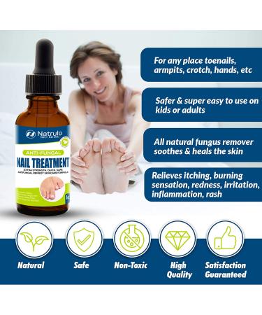 Extra Strength Natural Anti-Fungal Nail Treatment Drops - Homeopathic Herbal Fungus Killer for Toenails & Skin - Effective Athlete's Foot, Jock Itch, Ringworm Relief - Quick & Safe Antifungal Remedy - Buy Online on GoSupps.com