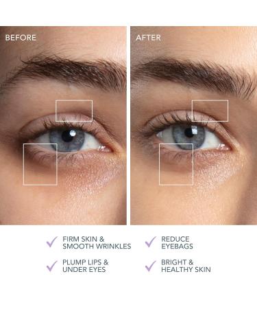 Buy FOREO Bear 2 Eyes & Lips - Microcurrent Eye Care Device for Dark Circles & Brow Lift - Instant Face Lift & Lip Plumper - Lavander Set - Best Beauty Product for Firming Skin - Buy Online on GoSupps.com