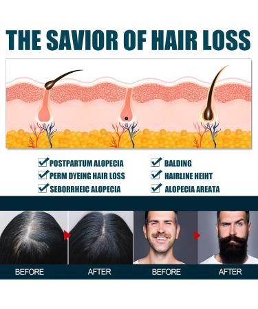  Miioto Miioto Hair Growth Serum Anti-Hair Loss for Men Hair Loss Very Fast Hair Growth Hydrates Roots and Regrowth - Buy Online on GoSupps.com