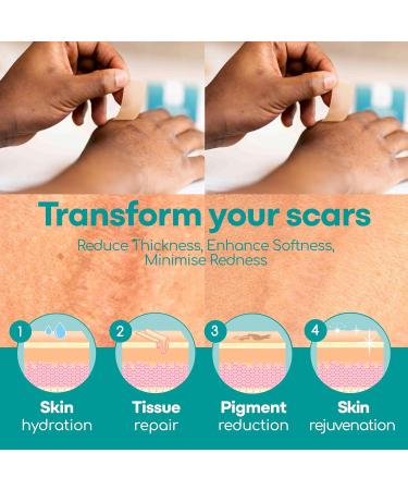 Medi Grade Silicone Scar Sheets - 80" Reusable Scar Tape for C-Section Keloid Burn & Acne Scars - Includes Hygienic Storage Case - Buy Online on GoSupps.com
