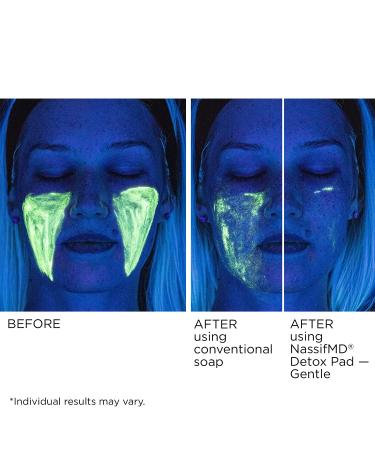 NassifMD Gentle Facial Radiance Detox Pads - Hyaluronic Acid Aloe Vera & Fruit Complex for Anti-Aging - 60ct Facial Scrub Pads for Sensitive Skin - Buy Online on GoSupps.com