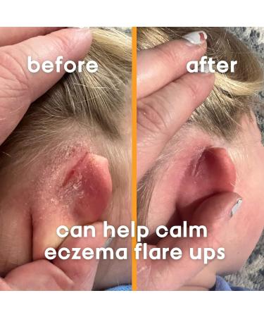 OoogieBear Organic Body Balm - Relief for Dry Itchy Skin & Congestion - Safe for Infants - Travel Size with Pouch - Doctor Made - Buy Online on GoSupps.com