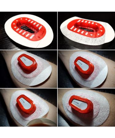 10 Count Infiniflex Hypoallergenic G6 Shield Patch Tapes - Waterproof Skinsoft Adhesive Overlay Cover Patches (Tan) | International Shipping Available - Buy Online on GoSupps.com