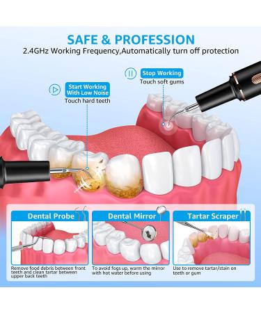 TANAVE Ultrasonic Plaque Remover Kit | Rechargeable Dental Tartar Remover with LED | Teeth Cleaning Tools for Tartar and Plaque Removal - Buy Online on GoSupps.com