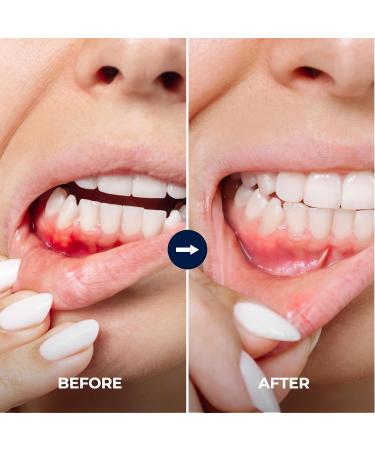 1950 Mineral Salt Blue Toothpaste - Jeju Lava Seawater Salt with Hydroxyapatite for Sensitive Teeth Gum Care Whitening Reminaeralizing Green Tea Freshness Fluoride Free SLS Free (3.5 oz) - Buy Online on GoSupps.com