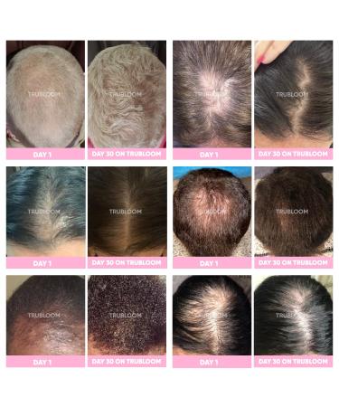 St. TROPICA Natural Hair Growth Vitamins - Clinically Proven Formula for Thicker, Fuller, Longer Hair - 30 Count - 1 Month Supply - Buy Online on GoSupps.com