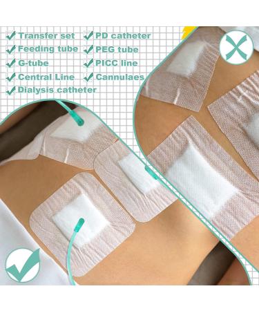 50 Pcs Feeding Tube Pads 4x4 inch - Adhesive Bandages for PD Catheter G Tubes - Dialysis Accessories and Supplies - Buy Online on GoSupps.com