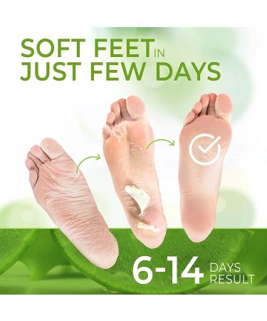 Foot Peel Mask with Aloe Vera (3 Pairs) | Exfoliating Dead Skin Remover for Feet - Buy Online on GoSupps.com