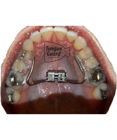 RPE Tongue Guard - Prevents and Heals Tongue Sores from Dental Expanders - Buy Online on GoSupps.com