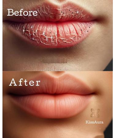 Lip Lightening Gloss for Dark Lips - for Smokers & Uneven Tone Brightening Hydrating Formula with Lemon Peel Licorice & Vitamin C Moisturizing Shine Refreshing Scent- 20 mL (Medium Mint) Mint 1 Fl Oz (Pack of 1) - Buy Online on GoSupps.com