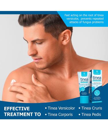 Roycederm Antifungal Cream for Tinea Versicolor, Athlete's Foot & Ringworm Treatment - Fast-Healing Multi-Functional Anti-Fungal Skin Cream - Buy Online on GoSupps.com