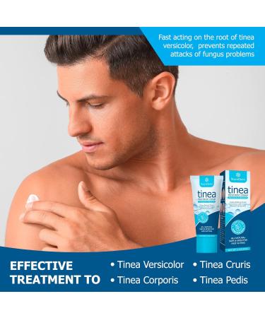 Roycederm Antifungal Cream for Tinea Versicolor & Athlete's Foot Treatment 2 oz - Fast Healing Anti Fungal Skin Cream - Buy Online on GoSupps.com