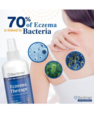 SkinSmart Antimicrobial Eczema Therapy - Pack of 3 - 2 Fl Oz. - Buy Online on GoSupps.com