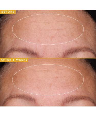 Farmacy Hyaluronic Acid Serum - Anti-Aging Hydrating Face Serum for Youthful Skin & Wrinkle Reduction (5ml) - International Shipping Available - Buy Online on GoSupps.com