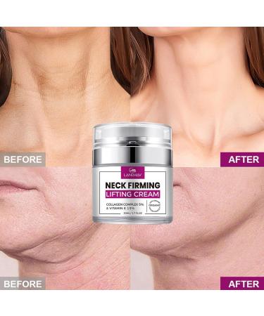 Neck Firming Lifting Cream | Organic Hyaluronic Acid & Jojoba Oil | Anti-Aging Moisturizer with Collagen & Vitamin E | Day & Night Facial Cream - Buy Online on GoSupps.com