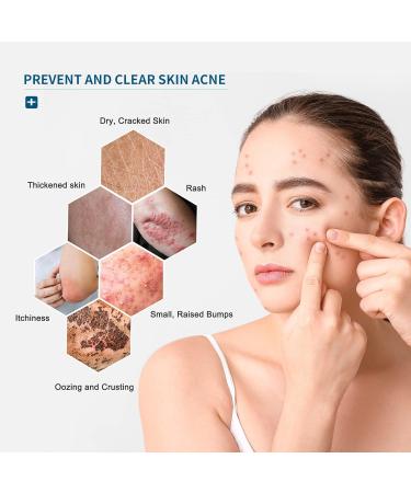 All-Natural Eczema Wipes | Fast Acting Relief with Oatmeal | Soothes Itching & Cracking | Organic Skin Protectant - Buy Online on GoSupps.com
