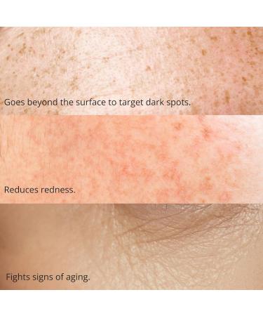 Buy Regenerative Elixir 30ml - Premium Anti-Aging Solution for Youthful Skin | International Shipping Available - Buy Online on GoSupps.com