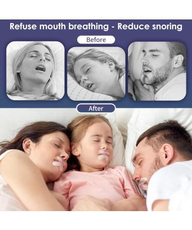 Buyisgle Snoring Solution Set - Stop Snoring and Sleep Better - 90 Anti-Snoring Devices for Men and Women - Buy Online on GoSupps.com