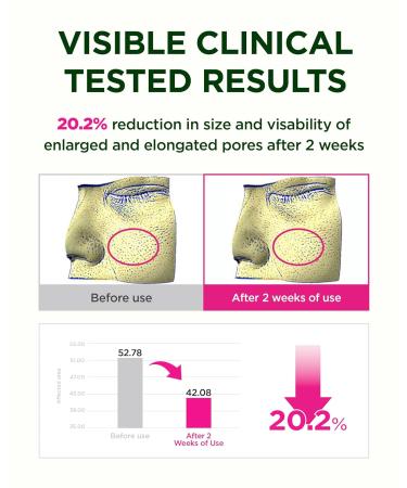 CKD Retinol Collagen Gua Sha Face Serum & Hydrogel Mask Set Firming & Lifting Anti-Aging Korean Skincare Bundle with Massage Roller & 5 Jelly Masks Reduces Wrinkles Pores & Boosts Radiance - Buy Online on GoSupps.com