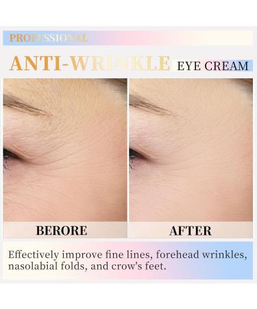 Luxurious Eye Cream with Retinol & Niacinamide for Anti-Aging Wrinkle Reduction & Radiant Skin - International Shipping Available - Buy Online on GoSupps.com