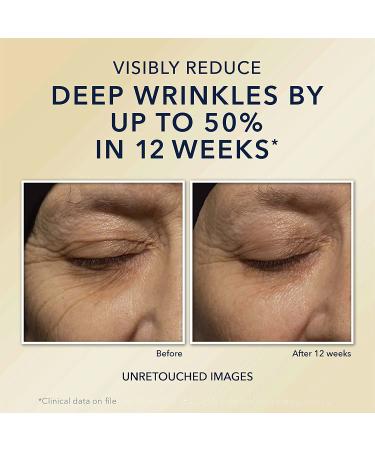 RoC Retinol Correxion Deep Wrinkle Night Cream - 1 oz | Anti-Aging Skin Care - Buy Online on GoSupps.com