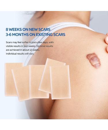 Puriderma Medical Silicone Scar Removal Sheets - Set of 5 | Fast & Effective on Keloid, Surgery, Burn, Acne, C-Section Scars - Buy Online on GoSupps.com