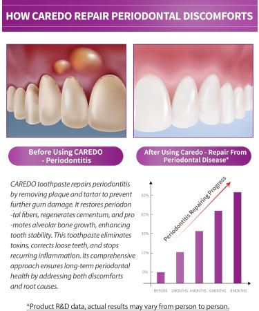 Buy Medicated Toothpaste for Periodontitis & Gum Care | Repair Gingivitis & Periodontal Disease Hydroxyapatite Mint Flavor (3.5oz) - International Shipping Available - Buy Online on GoSupps.com