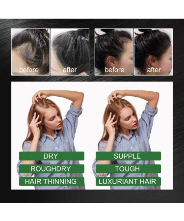 Hocossy Rosemary Oil for Hair Growth Organic Rosemary Essential Oil for Hair Care Hair Strengthening Oil for Stronger Healthier Hair Nourishes The Scalp 60ml - Buy Online on GoSupps.com