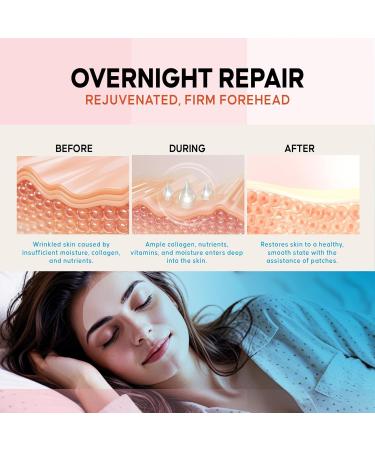 Forehead Wrinkle Patches - Anti-Wrinkle Treatment with Hydrolyzed Collagen & Vitamin E | 8pcs for Smooth Youthful Skin - Buy Online on GoSupps.com