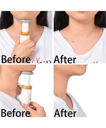 Kare & Kind Neck & Jaw Former - Double Chin Fat Remover - Slim & Shape Face Neck & Jaw Training Device for Men & Women - Buy Online on GoSupps.com