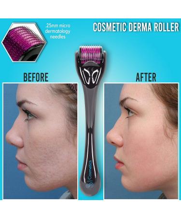 SB Cosmetics Premium Beard, Face, Scalp & Body Derma Roller 540 Titanium Micro Needle Beauty System - .25mm, Reusable - Buy Online on GoSupps.com