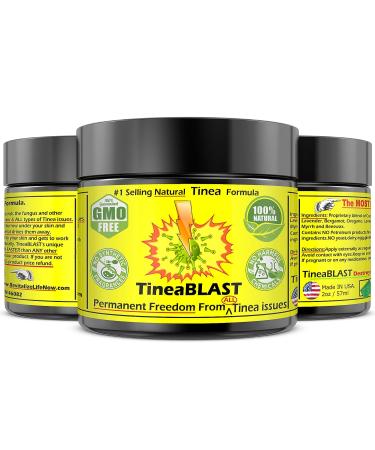Best Tinea Versicolor Treatment Cream: Fast Relief for Tinea Pedia, Cruris, Capitis, and Corporis - Natural and Effective Solution - Buy Online on GoSupps.com