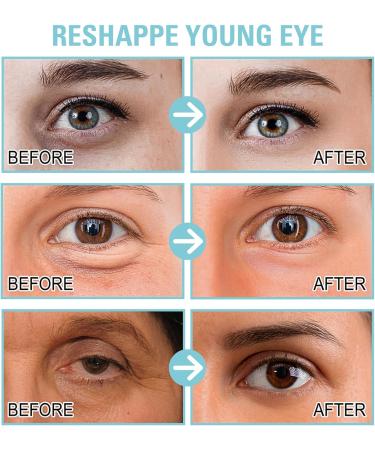 Instant Eye Tightener Eye Cream Caffeine Eye Cream Anti Aging Eye Cream For Dark Circles And Puffy Eyes Dark Circle Eye Cream Smooth That Delicate Skin Under Your Eyes Under Eye Cream Eye Care - Buy Online on GoSupps.com