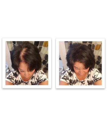 Caboki Hair Loss Concealer - All-Natural Hair Building Fibers - Travel Size, Dark Brown - Buy Online on GoSupps.com