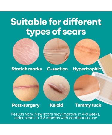 Medi Grade Silicone Scar Sheets - 80" Reusable Scar Tape for C-Section Keloid Burn & Acne Scars - Includes Hygienic Storage Case - Buy Online on GoSupps.com