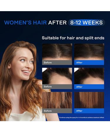 Intensive Hair Regrowth Treatment - 5% Active Complex | Natural Organic Formula for All Hair Types | 2 Fl OZ | Stop Hair Loss for Women & Men - Buy Online on GoSupps.com