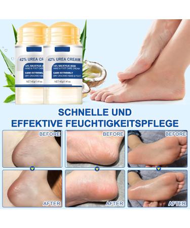 MrCuvaryas Foot Cream Stick Foot cream very dry feet calluses moisturizing foot cream very dry feet - Buy Online on GoSupps.com