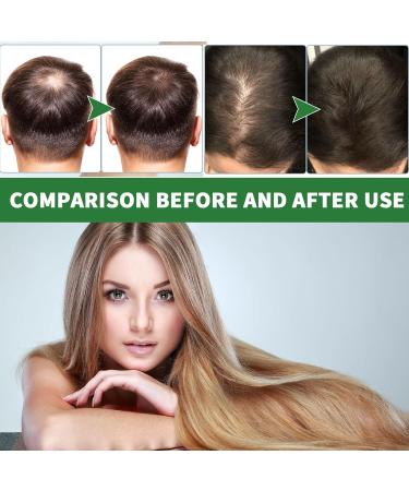 Rosemary Oil for Hair Growth Anti Hair Loss Hair Serum Rosemary Essential Oil With Peppermint Oil Coconut Oil And Castor Oil Extracts Hair Growth Oil for Women & Men 30ml - Buy Online on GoSupps.com