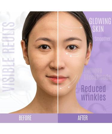 Dermaxgen Lift and Firm Serum - 30% Peptide Matrixyl 3000, Vitamin C & E, Hyaluronic Acid, Aloe Vera - Anti-aging Serum for Skin Tightening and Firming - 2 Fl Oz - Buy Online on GoSupps.com